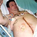 Weight Loss Surgery - Image Credit: Dale Leschnitzer