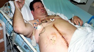 Weight Loss Surgery - Image Credit: Dale Leschnitzer